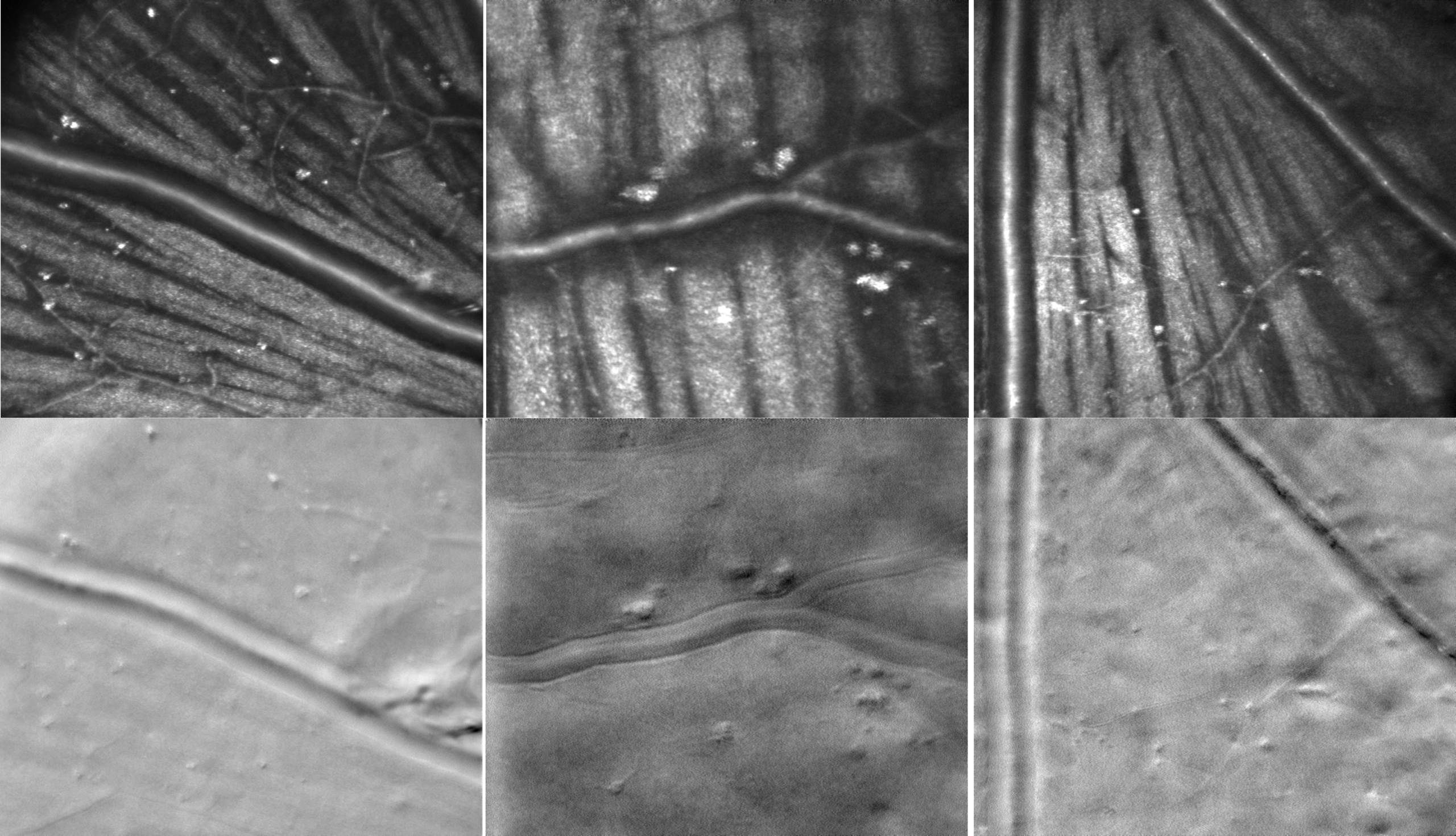 {{brizy_dc_image_alt imageSrc=