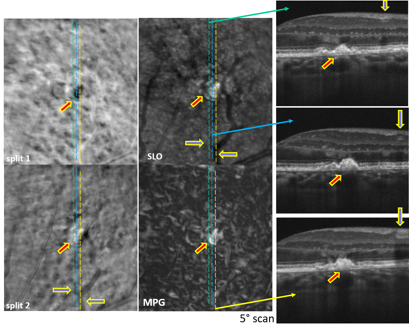 {{brizy_dc_image_alt imageSrc=